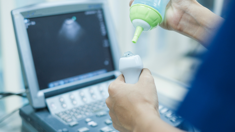 Siêu âm tim gắng sức và lưu ý khi thực hiện siêu âm tim gắng sức 3