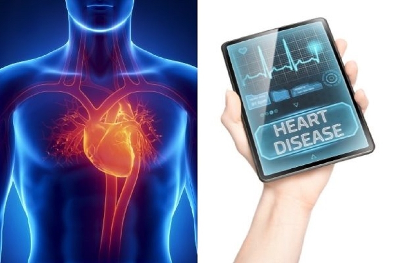 Siêu âm tim qua thực quản là gì? Những điều cần biết về phương pháp này 4