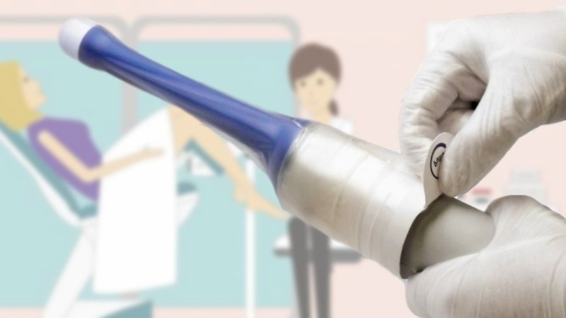 Siêu âm trực tràng và những điều cần biết 5