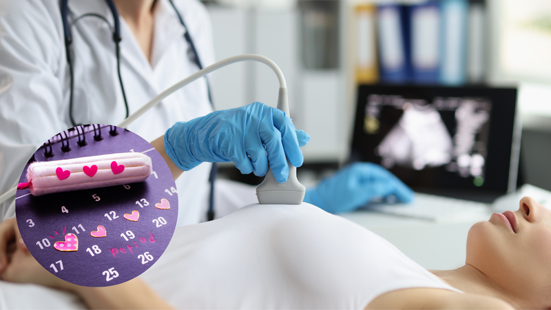Siêu âm vú khi có kinh nguyệt liệu có chính xác? 1