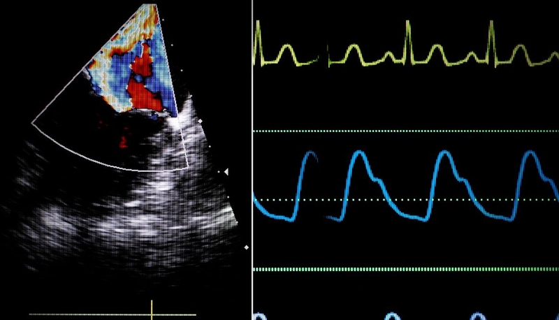 Sinh lý tim mạch: Tìm hiểu chi tiết về cấu trúc, chức năng, thông số 4