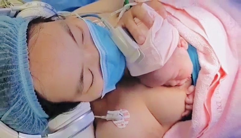 Sinh mổ là gì? Những điều cần biết về quá trình mổ lấy thai 6