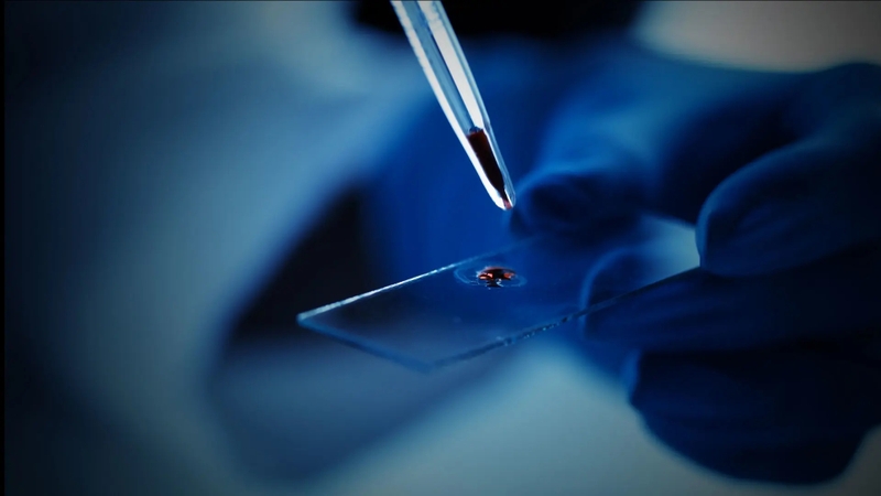 Sinh thiết khối u là gì? Sinh thiết khối u bao lâu có kết quả? 4