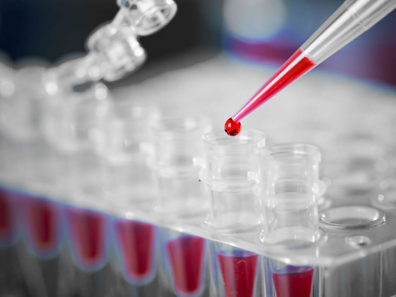 Sinh thiết lỏng có giúp chẩn đoán ung thư không? 3