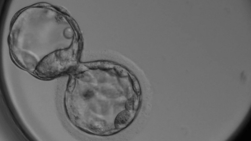 Sinh thiết phôi là gì? Chi phí sinh thiết phôi vào khoảng bao nhiêu? 3