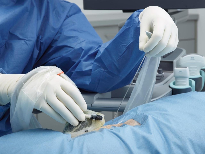 Sinh thiết phổi là gì? Sinh thiết phổi bao lâu thì có kết quả? 2