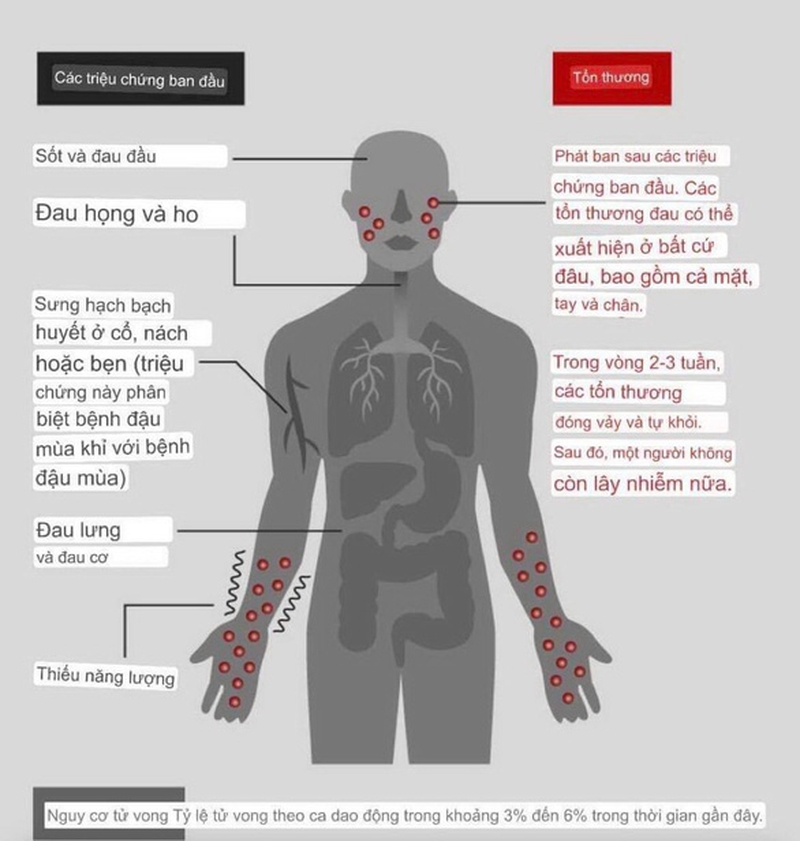 Thành phố Hồ Chí Minh ghi nhận ca đậu mùa khỉ thứ 2-3