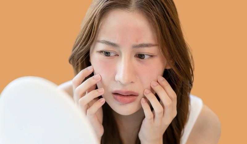 Skin Icing là gì? Lợi ích mà phương pháp Skin Icing mang lại 5