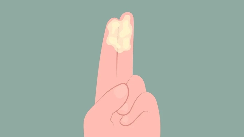 Bầu ra khí hư màu xanh là do đâu? Có nguy hiểm không? 1