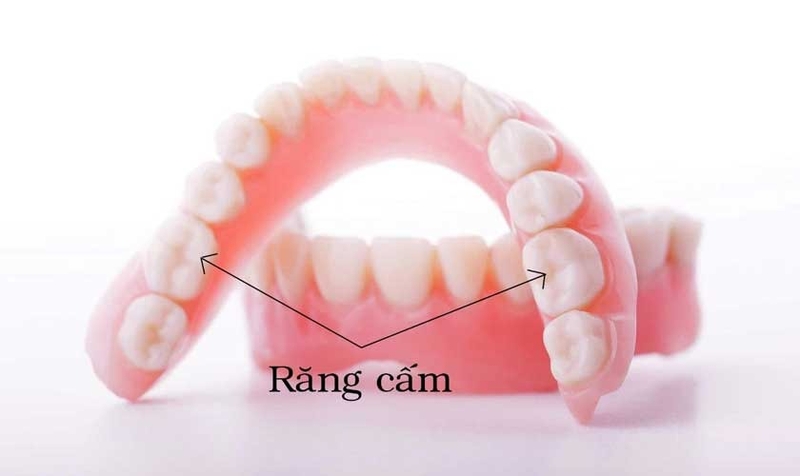 Bị mất răng cấm phải làm thế nào để khắc phục? 1