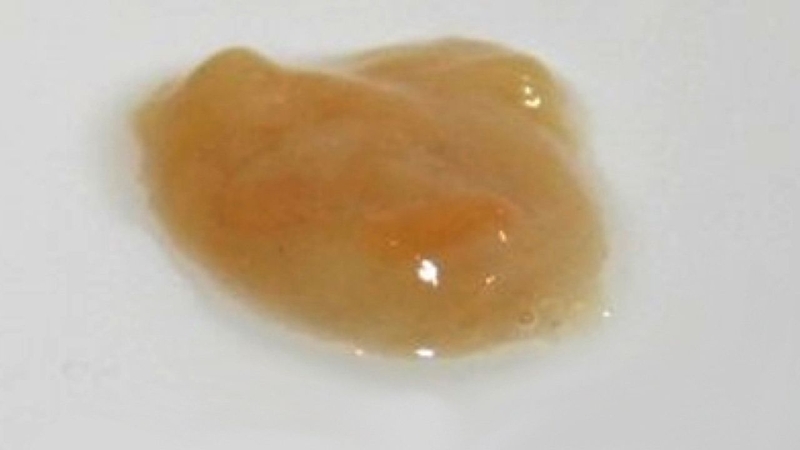 Đờm là một loại dịch tiết từ đường hô hấp, bao gồm khí quản, phế quản, các xoang hàm trán, hốc mũi và họng