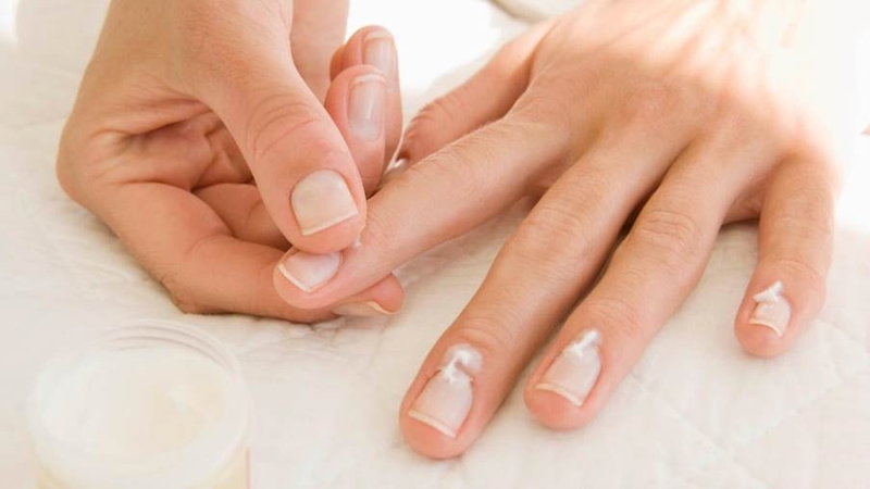 Loạn dưỡng móng là gì? Nguyên nhân, triệu chứng và cách điều trị 7