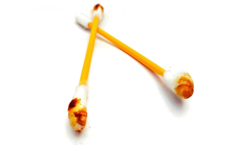 Ráy tai khô cứng cần xử lý thế nào 4