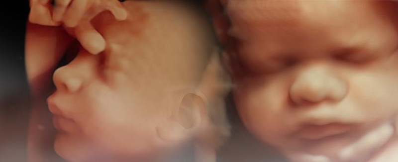 Siêu âm 5D có ảnh hưởng đến thai nhi không? 1