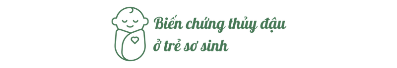 Sự cần thiết của việc tiêm phòng thủy đậu - Các bằng chứng khoa học về tính hiệu quả và an toàn của vắc xin h3 2