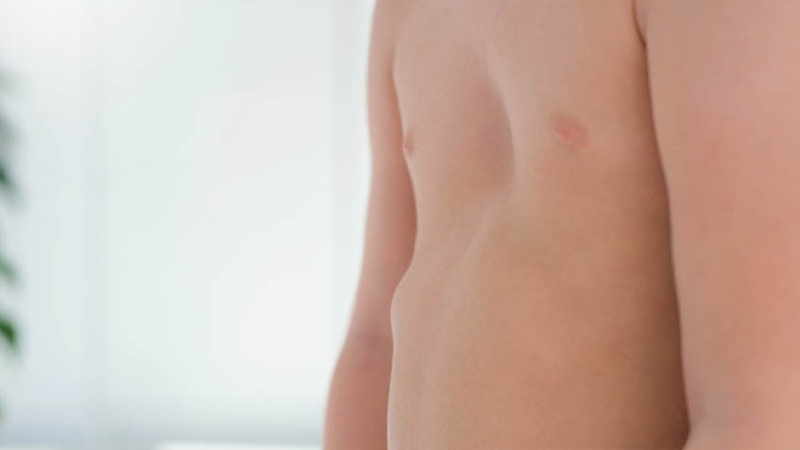 Trẻ bị còi xương nên bổ sung gì? 1