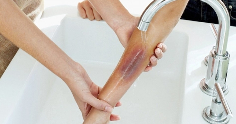 so-cuu-bi-bong-nen-lam-gi 2.jpg