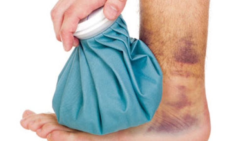 Cách sơ cứu bong gân cổ chân đúng cách 3