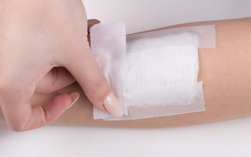 Những chia sẻ về sơ cứu bỏng nước sôi tại nhà hữu ích cho bạn