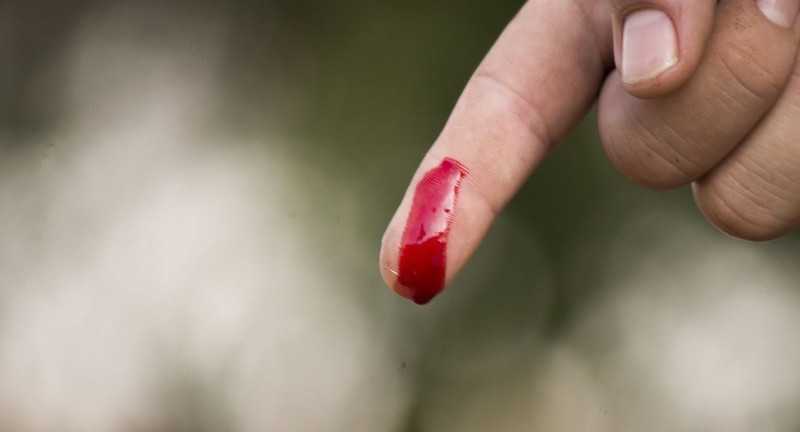 Sơ cứu đột quỵ bằng kim là như thế nào? Có nên thực hiện hay không?