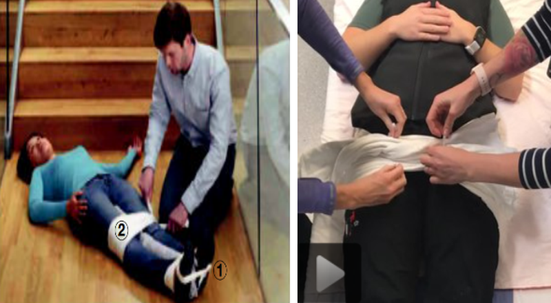 Phương pháp sơ cứu gãy xương chậu đúng cách 3