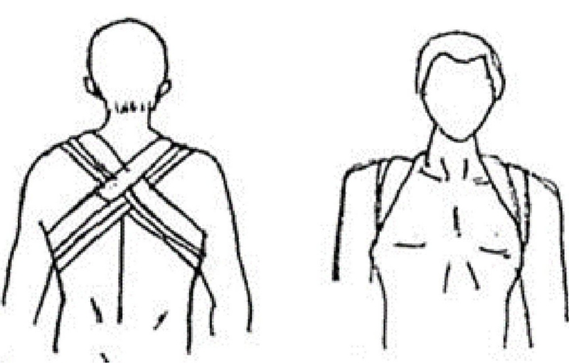 Sơ cứu gãy xương đòn như thế nào là đúng 4