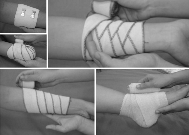 Sơ cứu và băng bó cho người bị gãy xương thế nào là chính xác 5