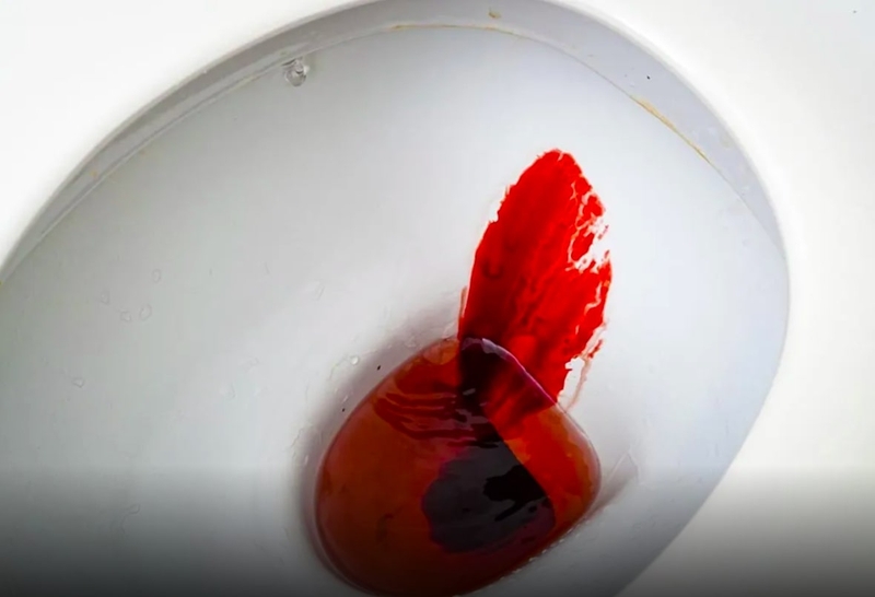 Sơ cứu xuất huyết tiêu hóa 3