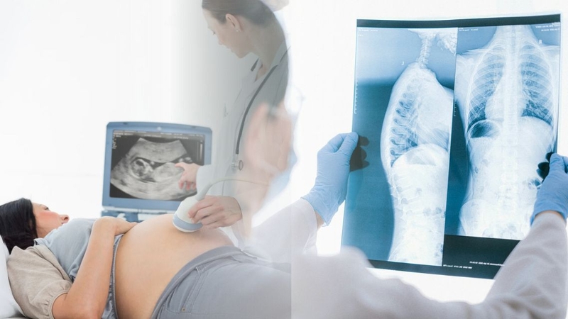 So sánh chụp X quang và siêu âm: Ưu điểm, hạn chế và ứng dụng 1