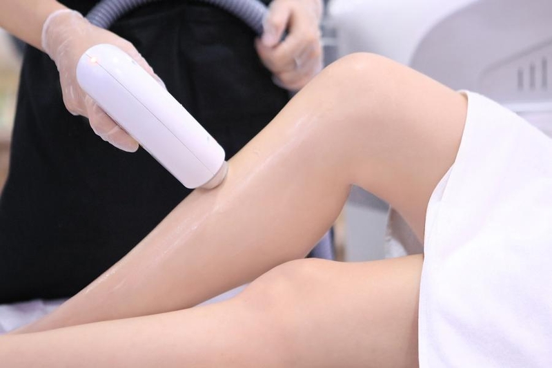 So sánh công nghệ DPL và Diode Laser khác nhau ở điểm gì? 1