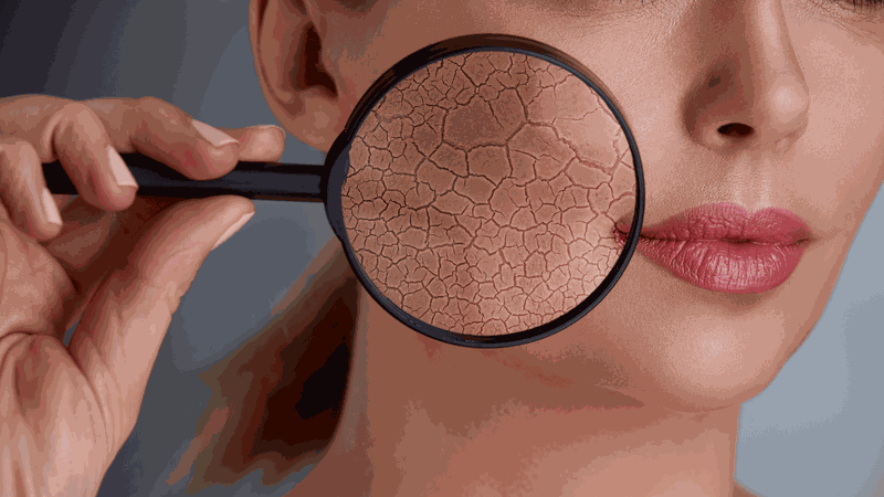 so sánh thermage và ultherapy lựa chọn nào tốt hơn cho sức khỏe và sắc đẹp của bạn 1