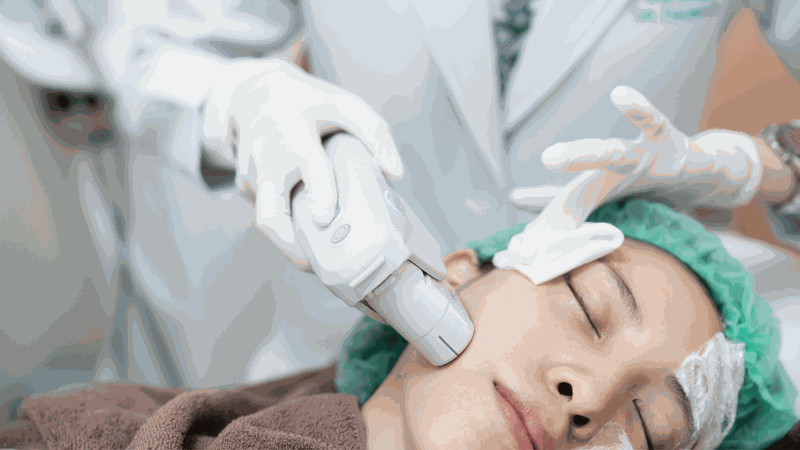 so sánh thermage và ultherapy lựa chọn nào tốt hơn cho sức khỏe và sắc đẹp của bạn 2