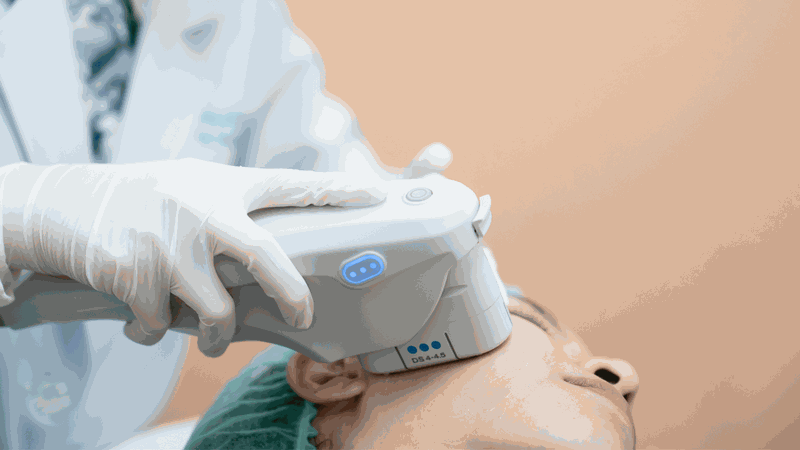 so sánh thermage và ultherapy lựa chọn nào tốt hơn cho sức khỏe và sắc đẹp của bạn 3