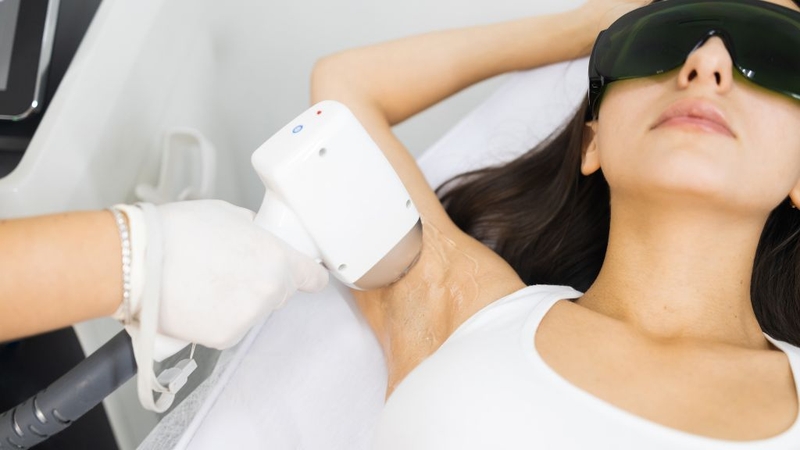 So sánh triệt lông nóng và lạnh: Nên chọn phương pháp nào? 1