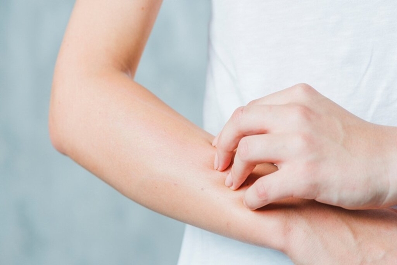 Sốc phản vệ độ 2 là gì? Sự nguy hiểm của tình trạng sốc phản vệ độ 2 1