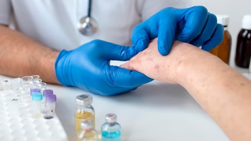 Sốc phản vệ độ 3 là gì? Nguyên nhân, triệu chứng và cách xử lý kịp thời 3