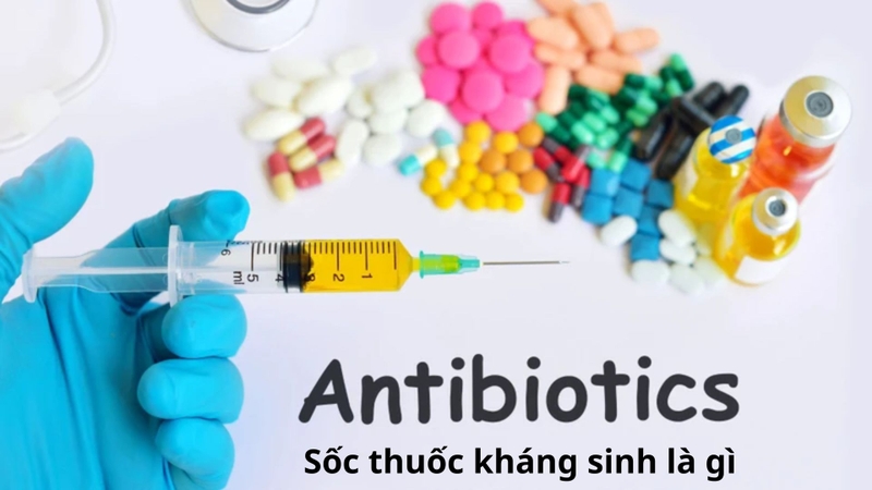 Sốc thuốc kháng sinh là một dạng sốc phản vệ vô cùng nghiêm trọng