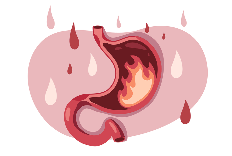 Sôi bụng ợ hơi buồn nôn là dấu hiệu của bệnh lý nào?-2