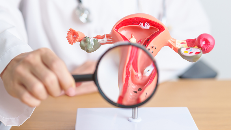 Soi cổ tử cung bao lâu có kết quả? 1