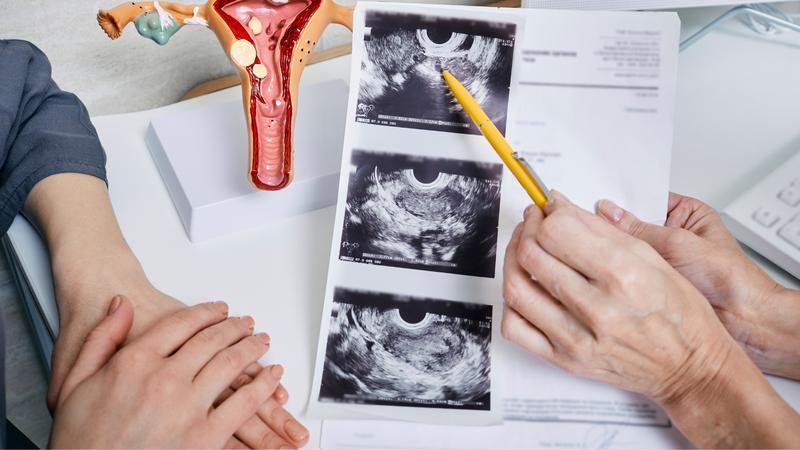 Soi cổ tử cung bao lâu có kết quả? 2