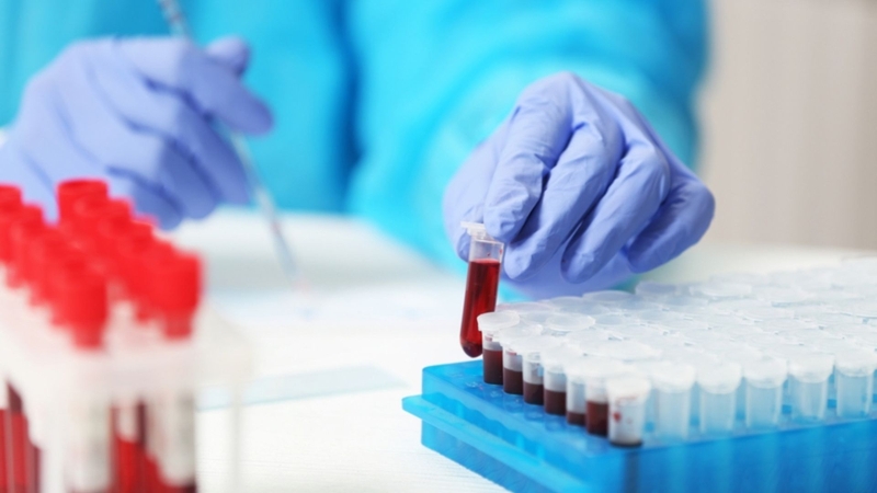 Lấy mẫu máu là bước đầu tiên và quan trọng trong quá trình soi ký sinh trùng sốt rét