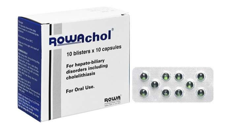 sỏi mật có ở mấy vị trí nguyên nhân triệu chứng và cách điều trị 3