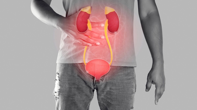 Sỏi niệu đạo ở nam: Nguyên nhân, triệu chứng và phương hướng điều trị 2