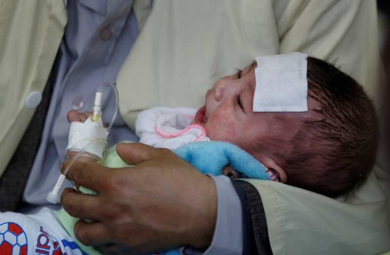 Cảnh giác với những biến chứng bệnh sởi ở trẻ em 3