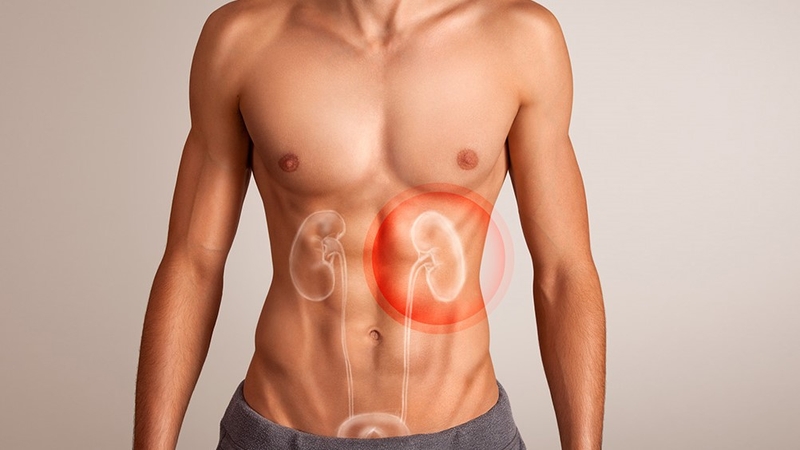 Sỏi thận hình thành như thế nào? Các loại sỏi thận thường gặp nhất 3