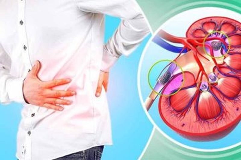 Trả lời thắc mắc: Sỏi thận uống bia được không? 1