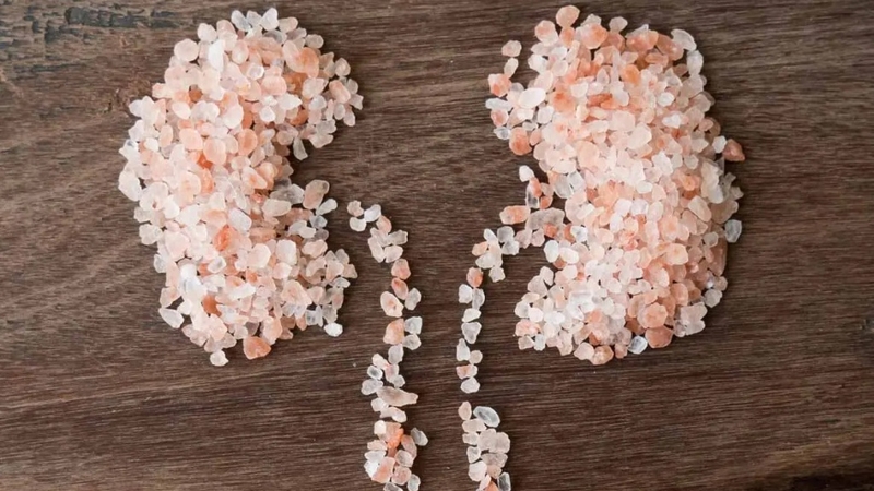 Sỏi thận và các bệnh tiết niệu thường gặp khác 2