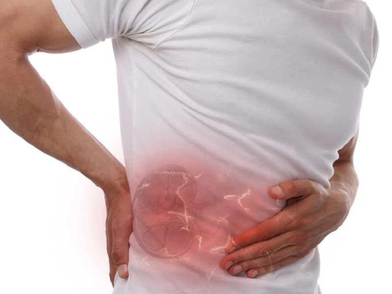 Sỏi túi mật 16mm có cần phẫu thuật hay không? 3