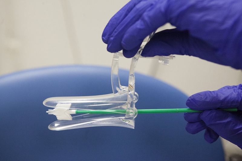 Tìm hiểu chi tiết về xét nghiệm soi tươi cổ tử cung 2