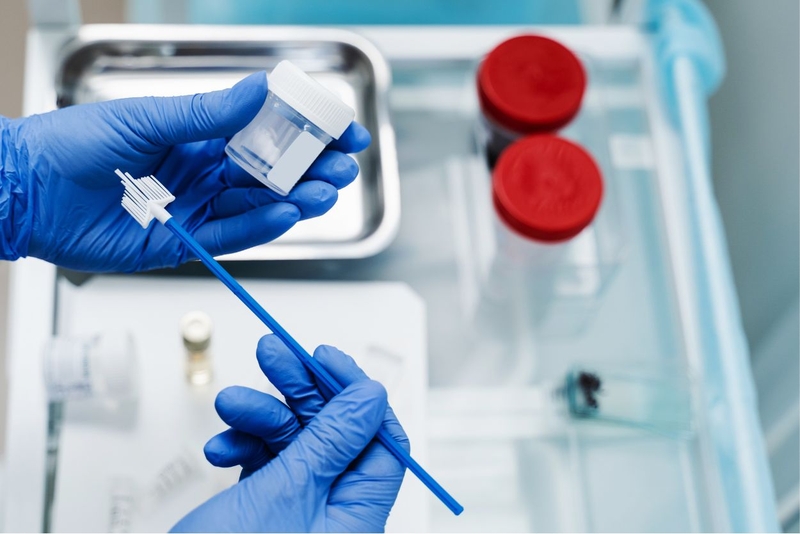 Tìm hiểu chi tiết về xét nghiệm soi tươi cổ tử cung 3